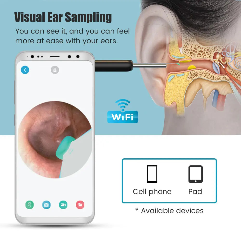 Wireless Visual Ear Pick Camera Ear Wax Removal Tool Picker Ear Cleaner Wax Removal Earwax Cleaning Endoscope Kit Spoon Earpick